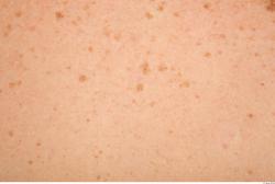 Photo Textures of Human Skin